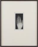 Eder & Valenta  Hand eines 8 jährigen Mädchens. circa 1878. Radiographie. 17 x 8,2 cm